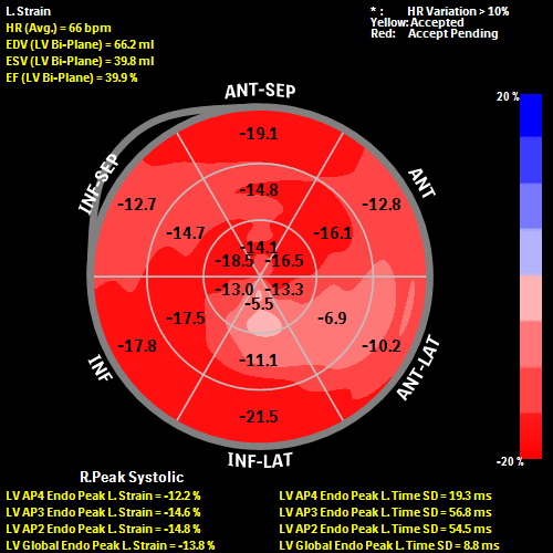 global longitudinal strain normal values